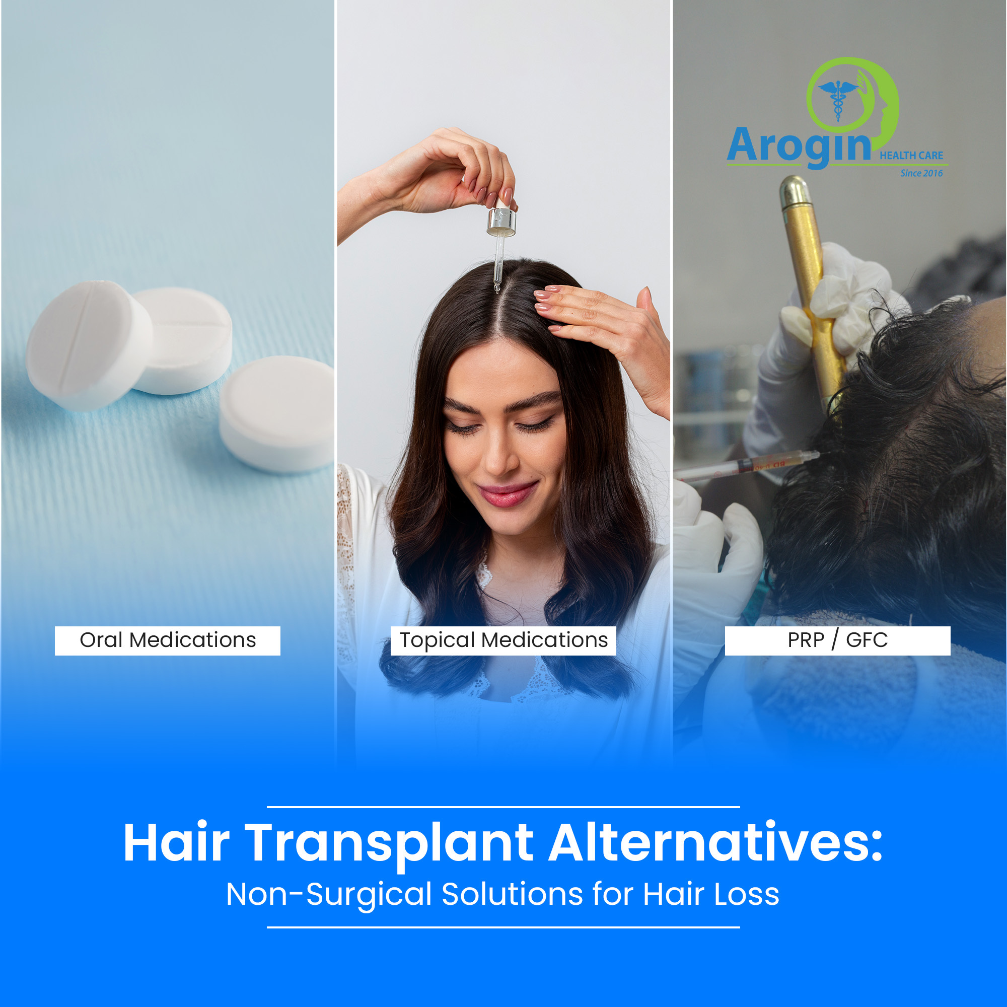 Hair Transplant Alternatives: Non Surgical Solutions for Hair Loss